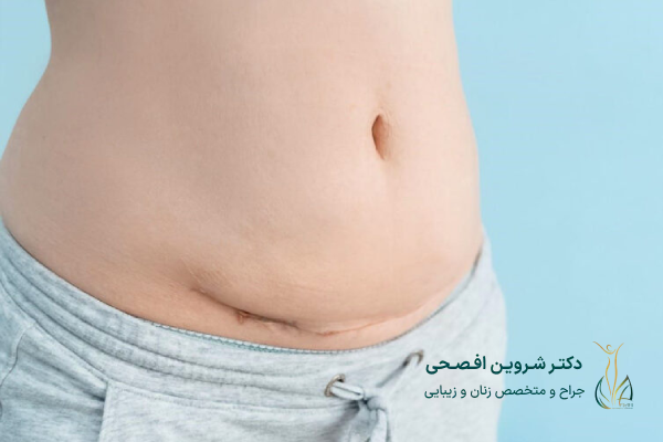شکم در بارداری چه تغییراتی می‌کند؟