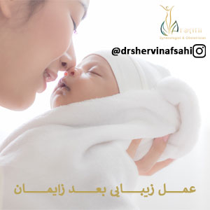 عمل زیبایی واژن بعد زایمان