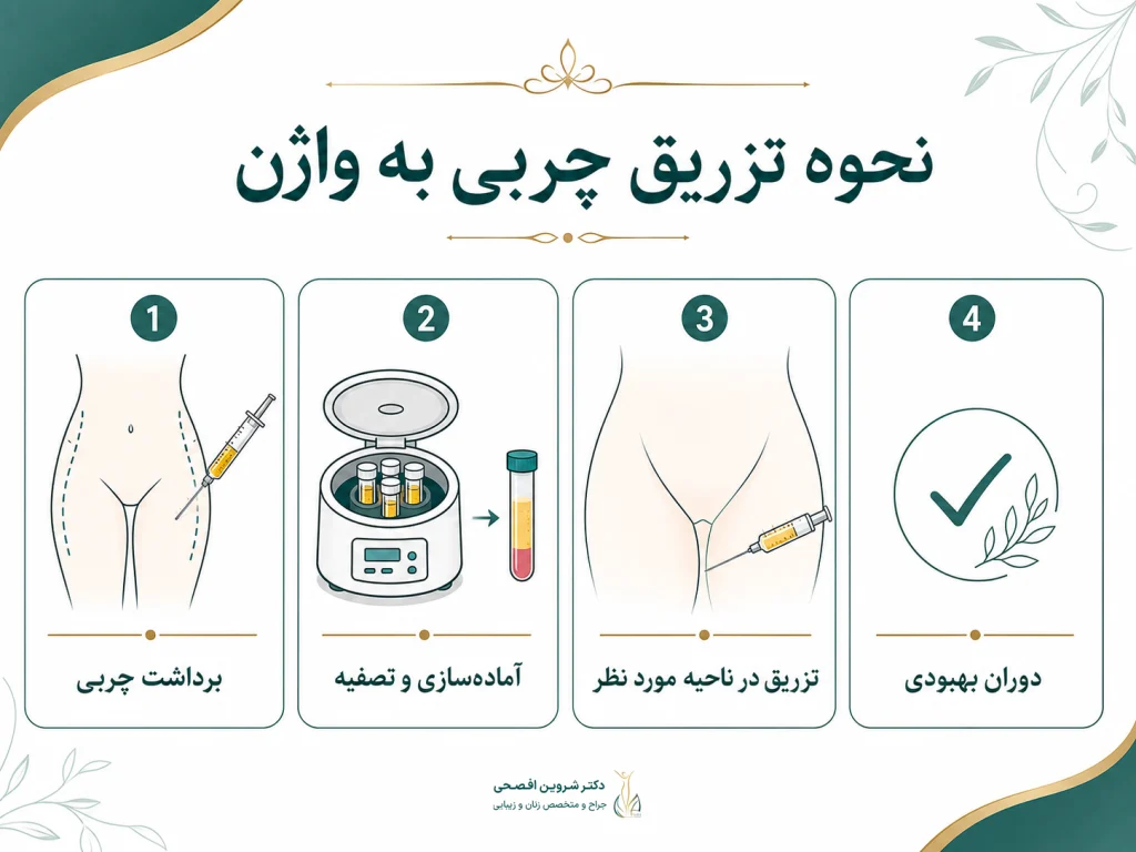 نحوه تزریق چربی به واژن
