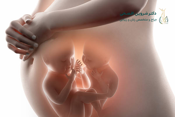 چه عواملی باعث بارداری دوقلویی میشود؟