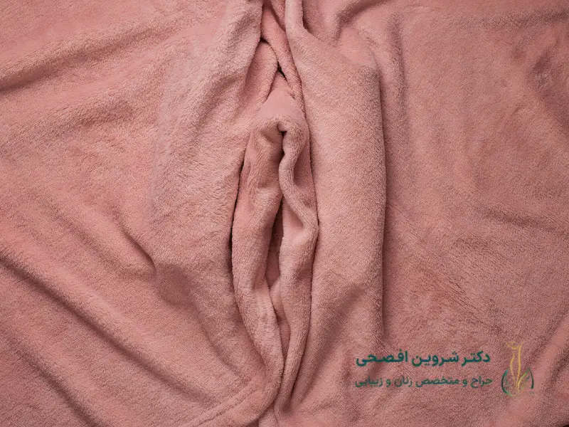 لابیا ماژور پلاستی-شاخص