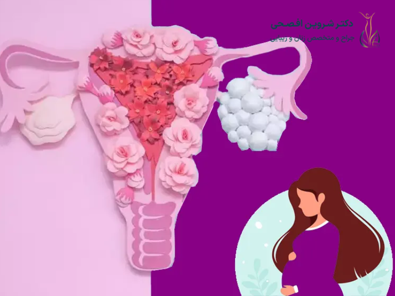تاثیر تنبلی تخمدان بر بارداری؛ سلامت حاملگی!