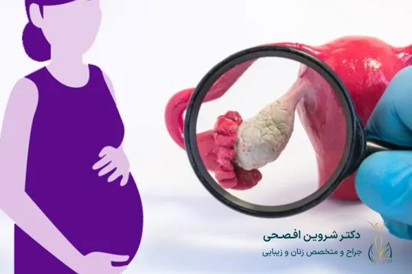 تنبلی تخمدان چیست؟