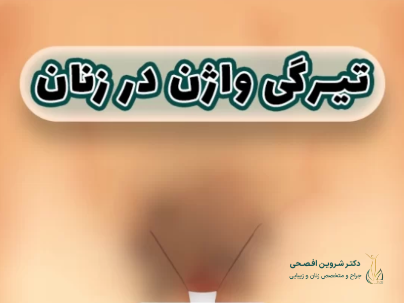 سفید کردن واژن بعد از زایمان