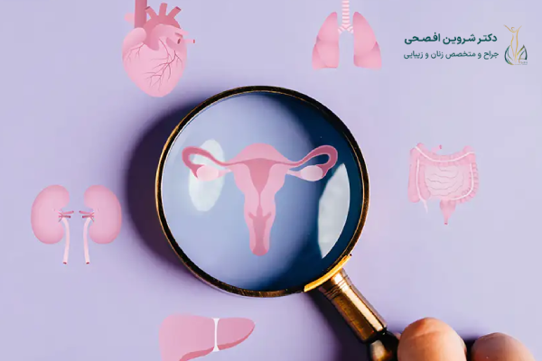 تفاوتهای مهم بین تنبلی تخمدان و پرولاکتین بالا