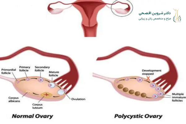 پرولاکتین چیست و چه نقشی در بدن دارد؟